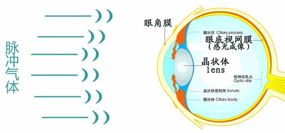 加加明预防近视的原理